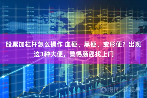 股票加杠杆怎么操作 血便、黑便、变形便？出现这3种大便，警惕肠癌找上门